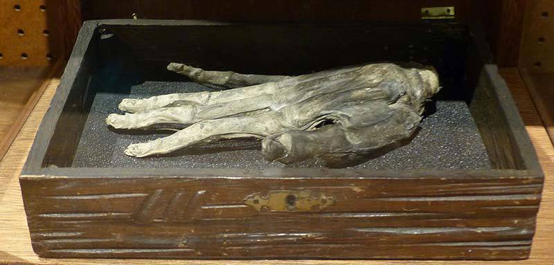 Hand Of Glory Whitby Museum