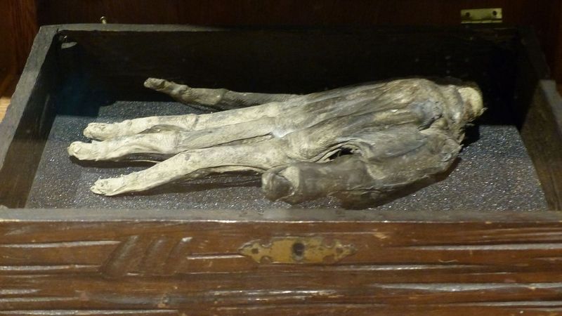 Whitby Museum Hand of Glory